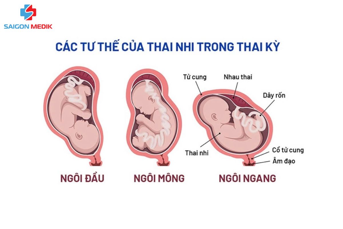 Thai nhi 23 tuổi thường nằm theo tư thế ngôi mông