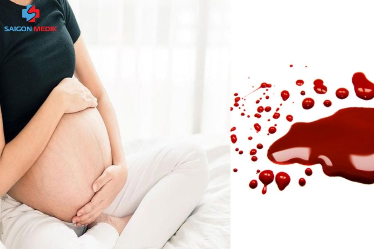 Dịch âm đạo xuất hiện máu báo là dấu hiệu của việc chuyển dạ sớm