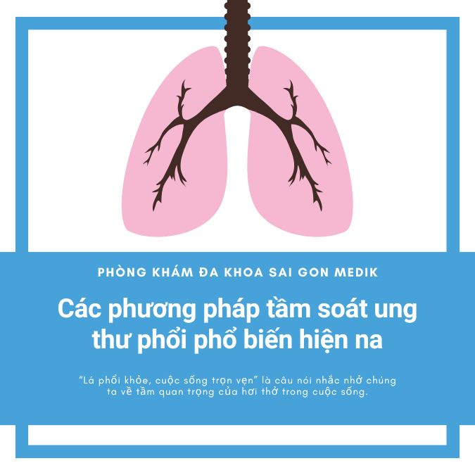 Các phương pháp tầm soát ung thư phổi phổ biến hiện nay